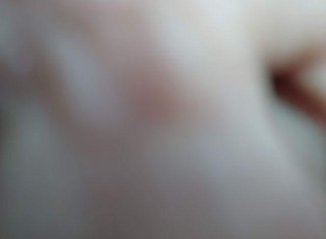 thumb 14