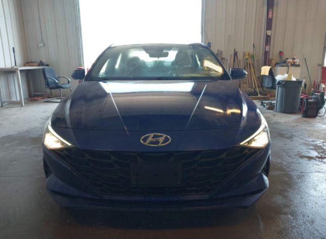 thumb 14